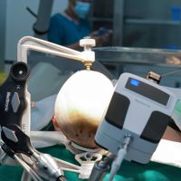 Vinmec tiên phong điều trị động kinh bằng Robot định vị thần kinh hàng đầu thế giới