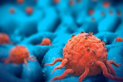 [Video] Tế bào ung thư có thể bị vô hiệu hóa trong môi trường vi trọng lực