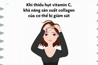[Video] 9 bất thường cảnh báo cơ thể thiếu vitamin C