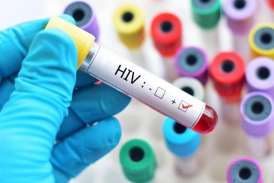  Phát hiện chủng virus HIV mới 