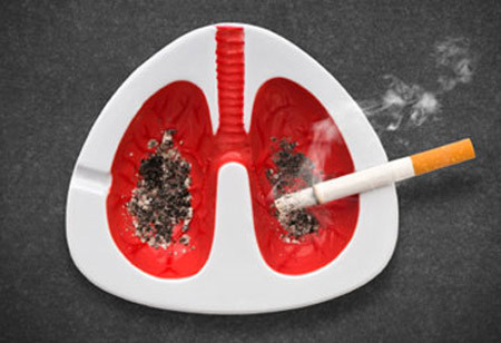 Thuốc lá là tác nhân gây ung thư phổi và nhiều bệnh hiểm nghèo khác. Nguồn: internet 