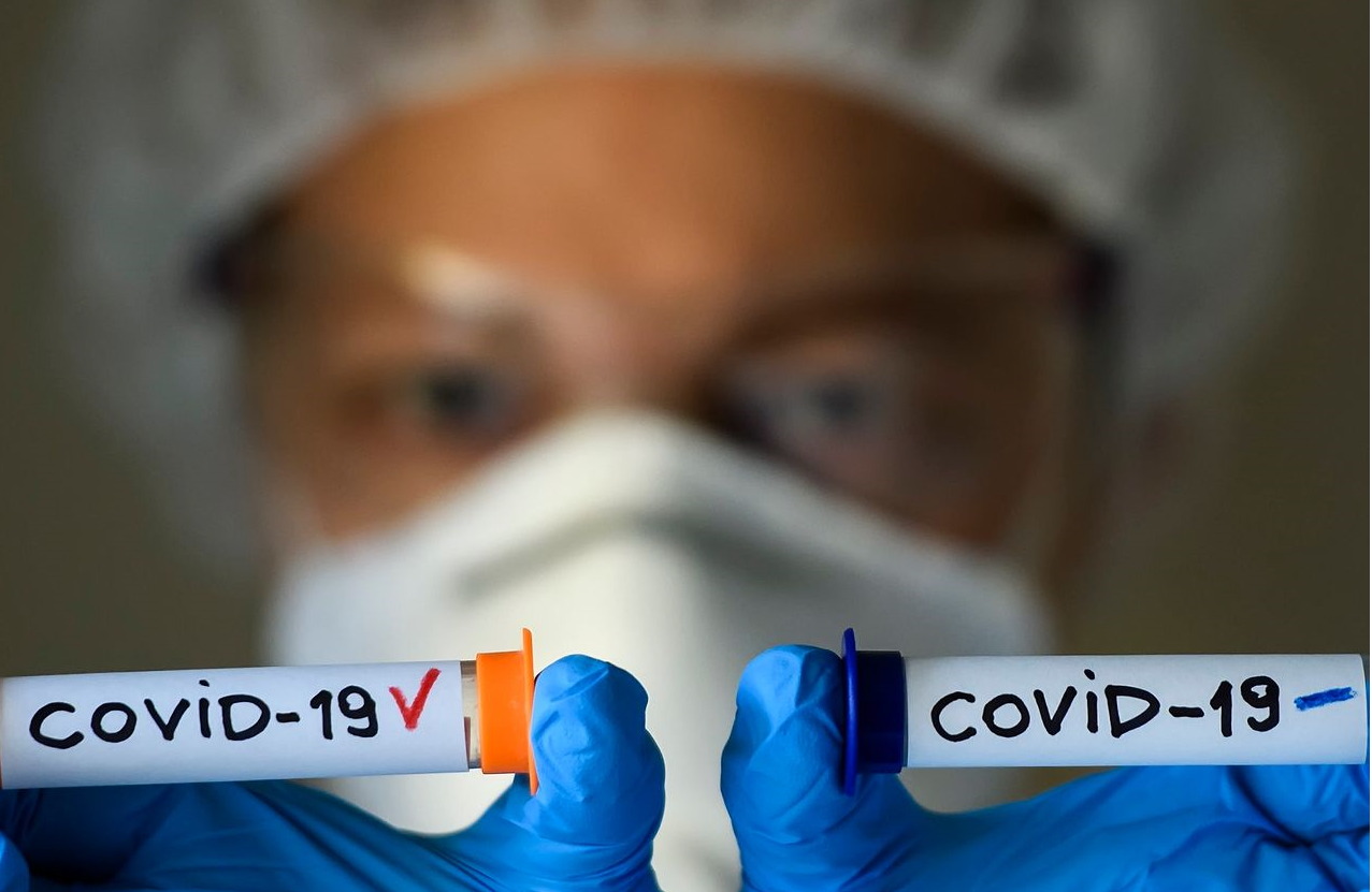 Theo Worldometer, đến sáng 27/3/2020, tổng số ca nhiễm Covid-19 tại Mỹ là 85.088; với 1.290 trường hợp tử vong. Nguồn: internet