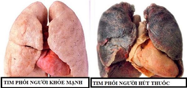 Thuốc lá tàn phá tim và phổi của bạn.