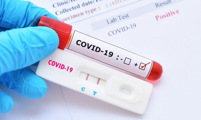 Những sai lầm khi sử dụng test và thuốc điều trị COVID-19